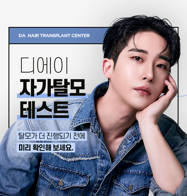 자가탈모 테스트
