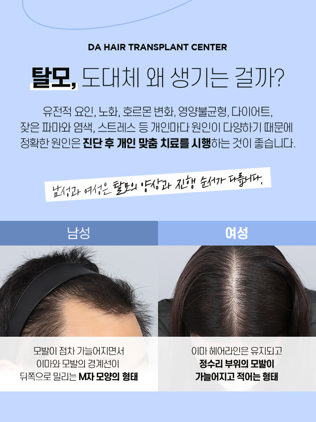 자가탈모 테스트