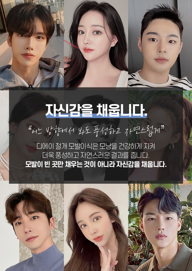 절개 모발이식