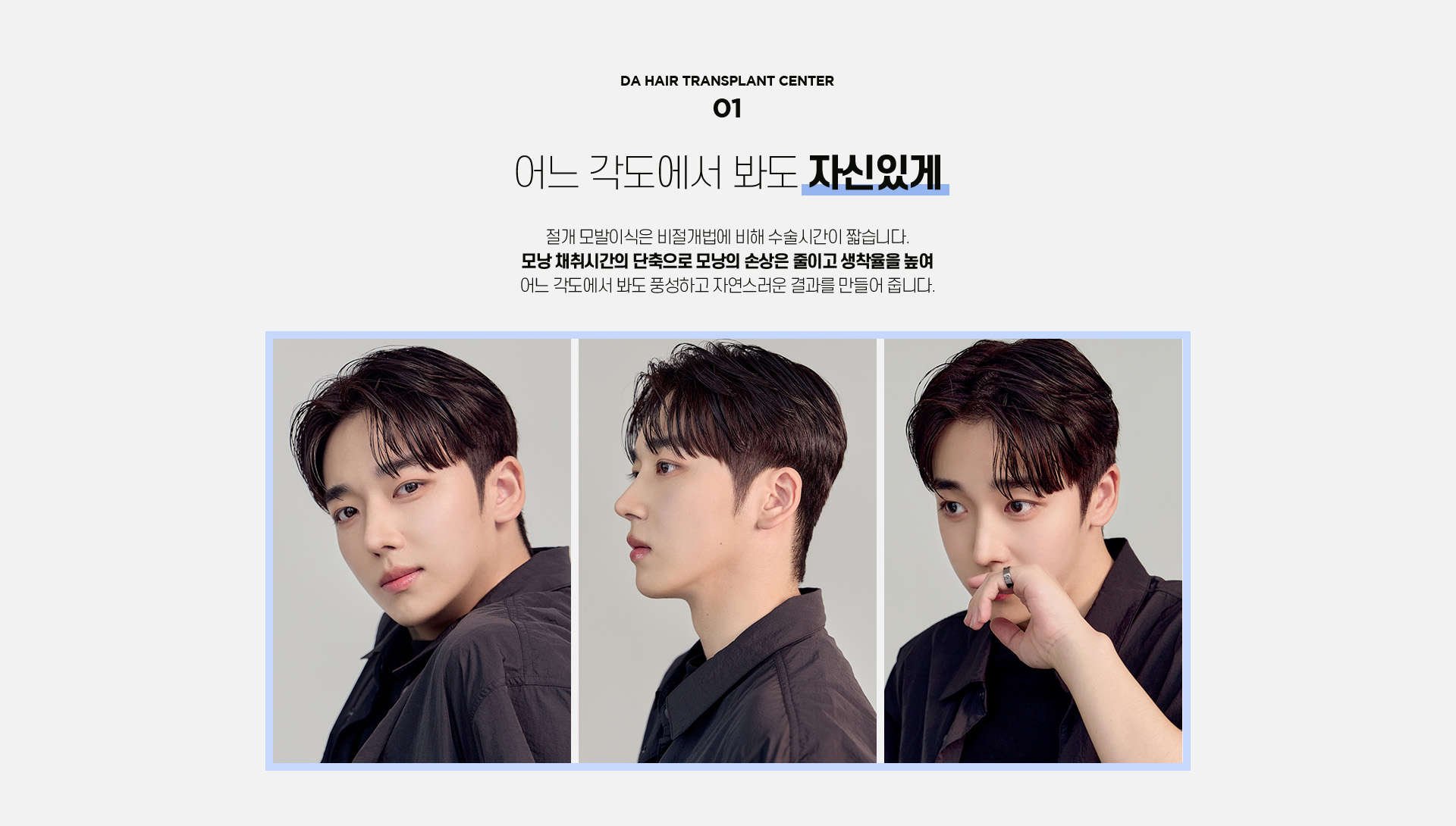 절개 모발이식