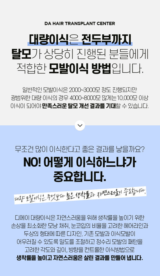 대량 모발이식