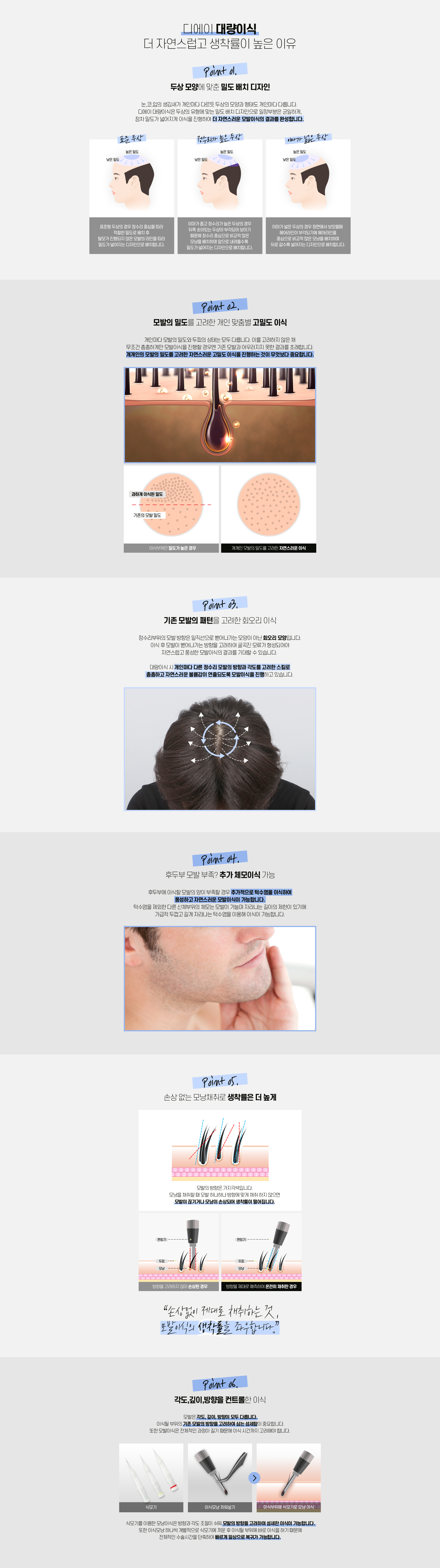 대량 모발이식