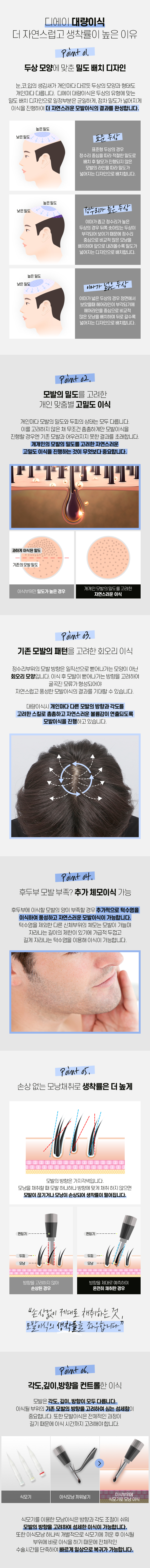 대량 모발이식