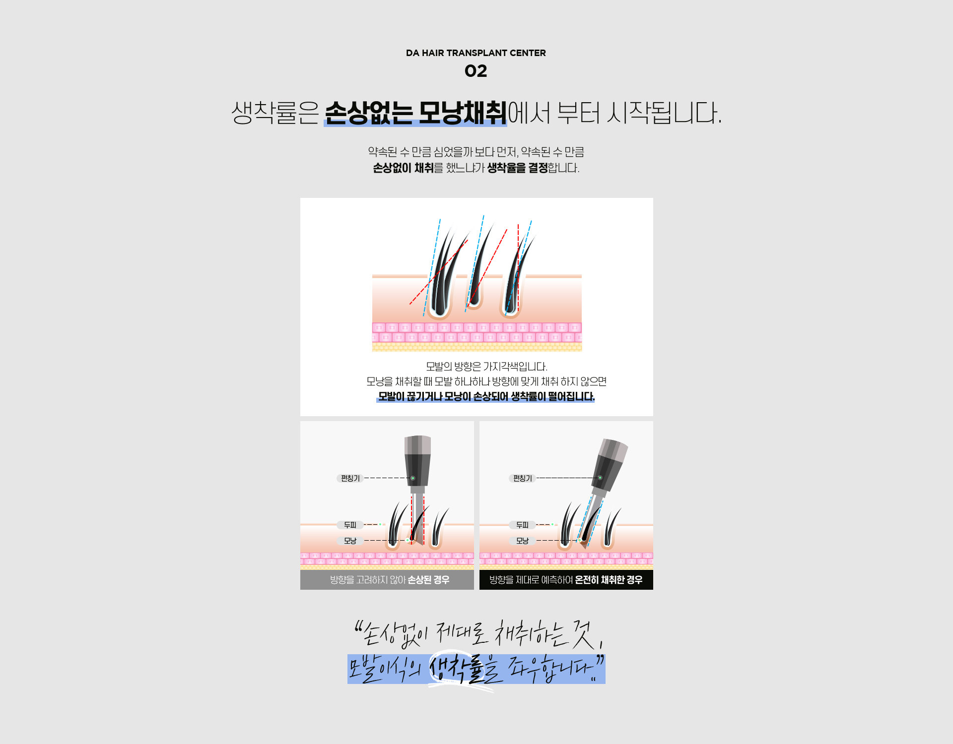 남자 헤어라인