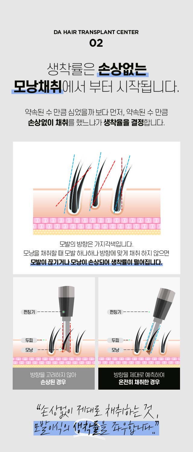 남자 헤어라인