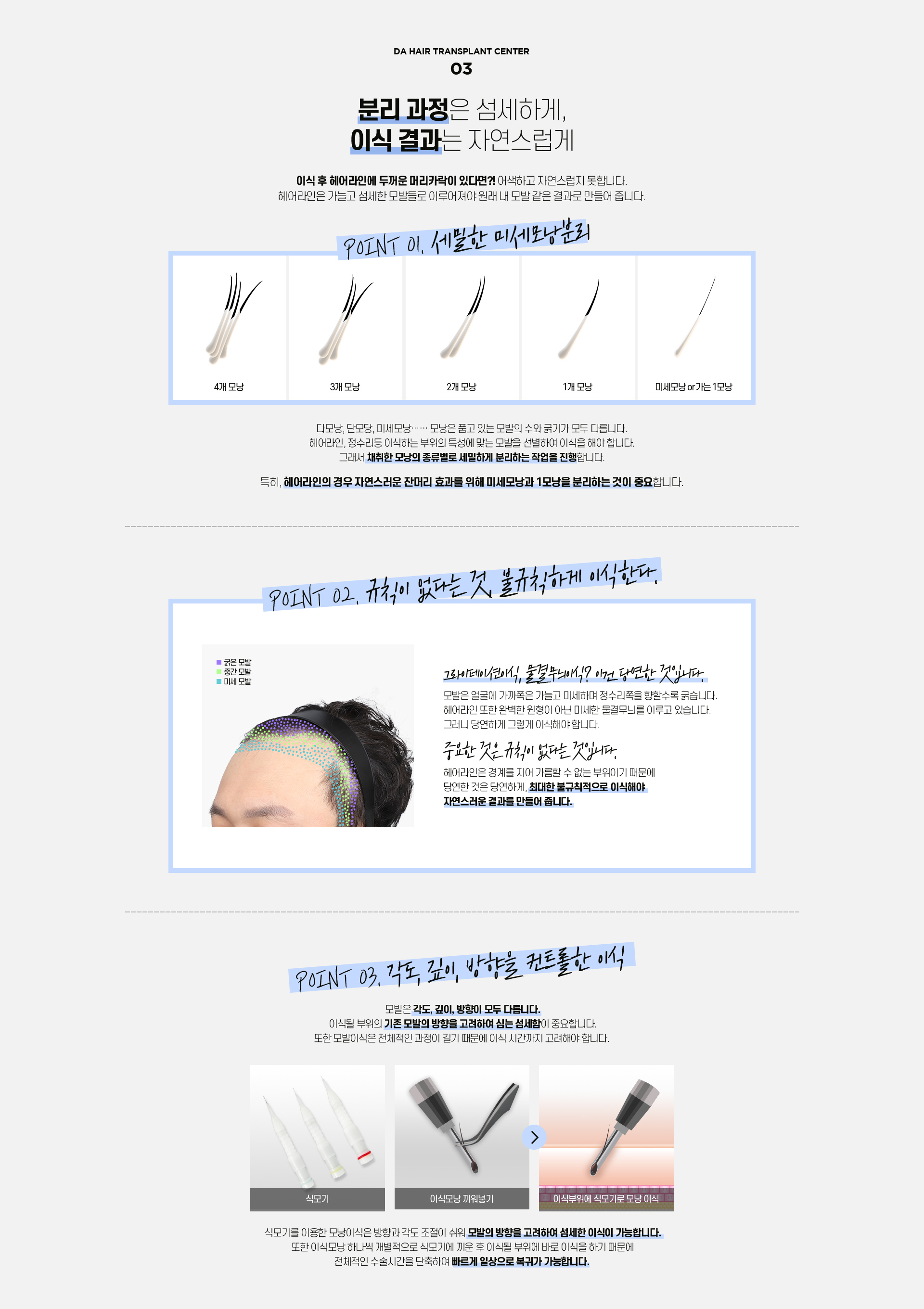 남자 헤어라인