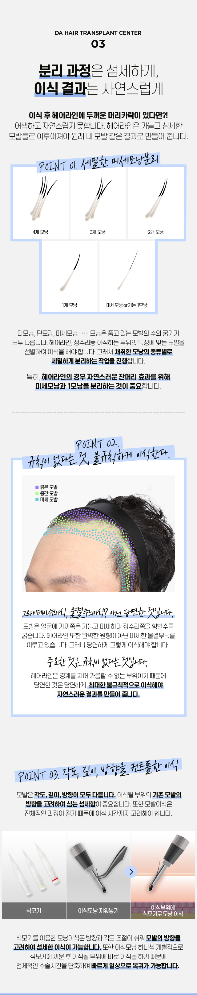 남자 헤어라인