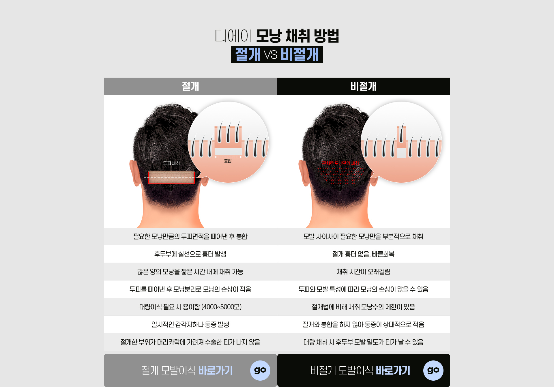 남자 헤어라인