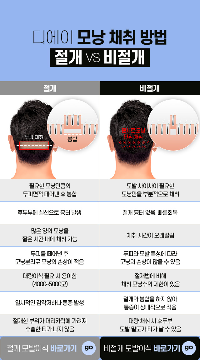남자 헤어라인