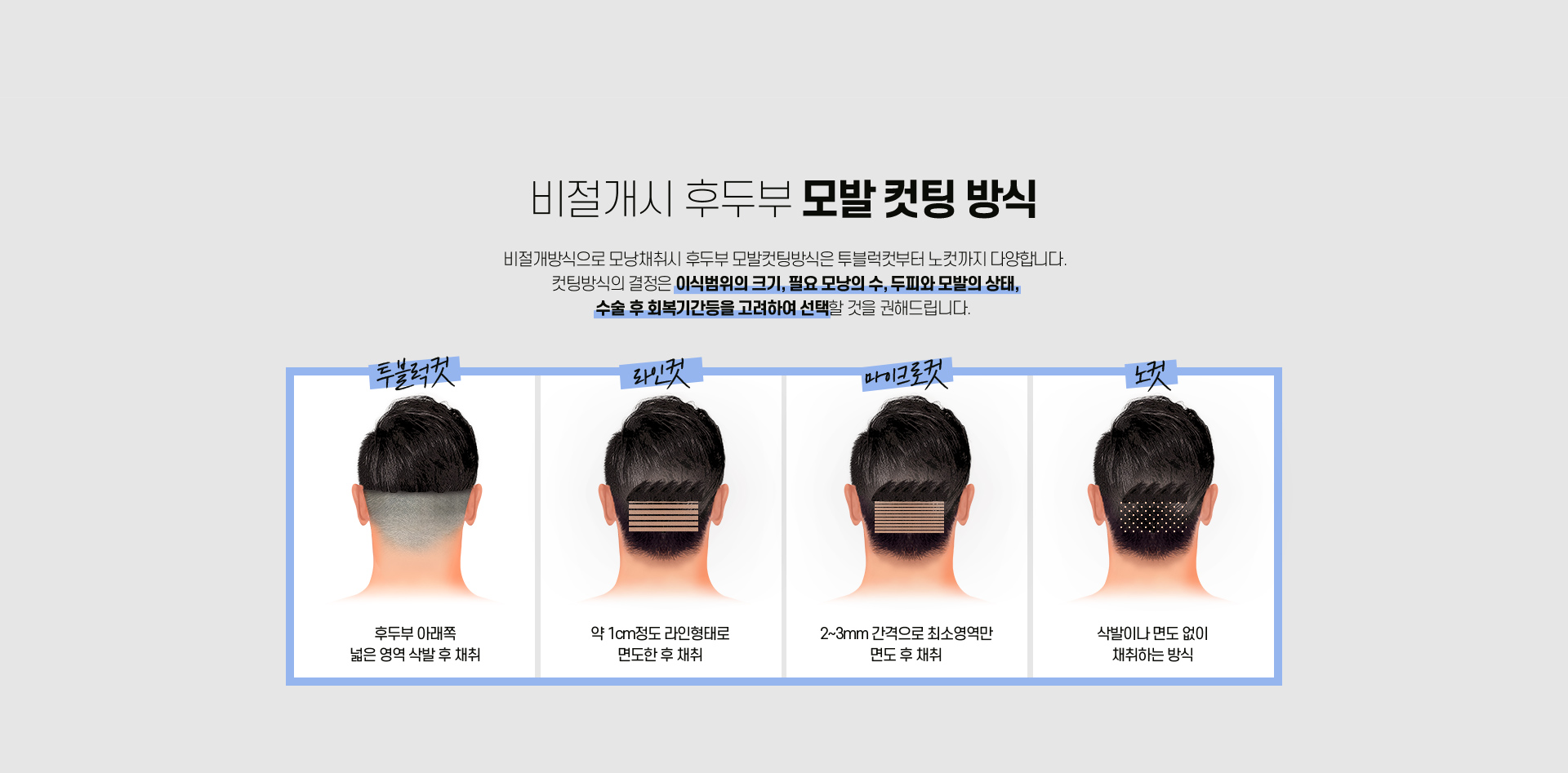 남자 헤어라인