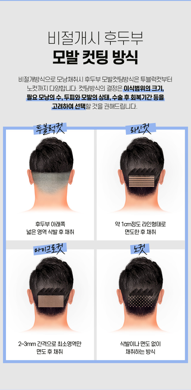 남자 헤어라인