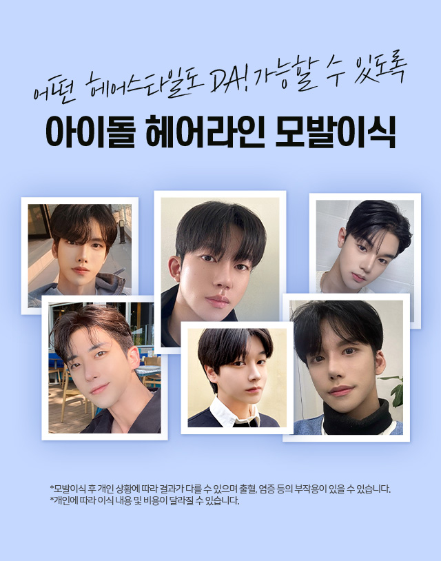 남자 헤어라인