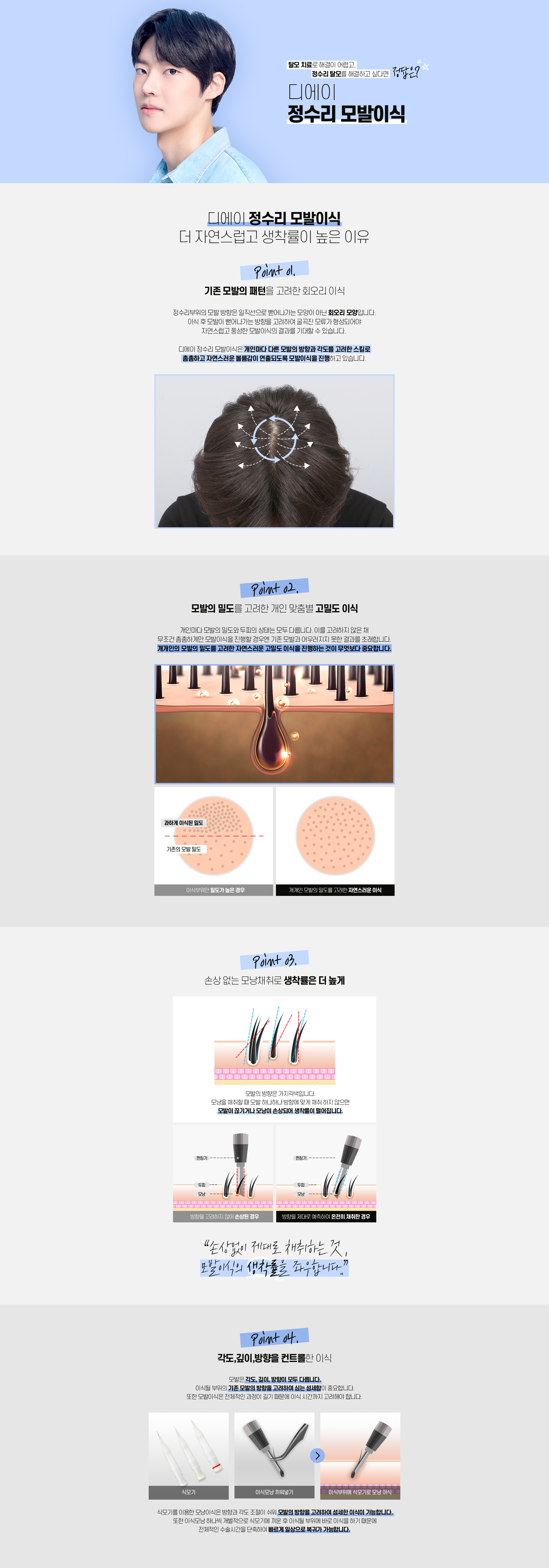 남자 정수리 모발이식