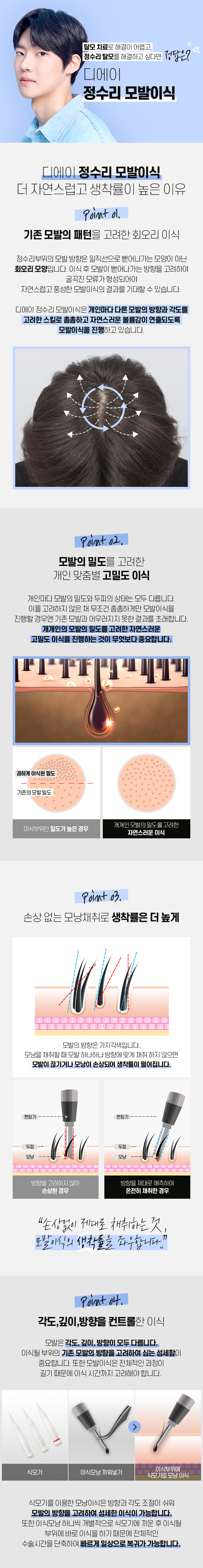 남자 정수리 모발이식