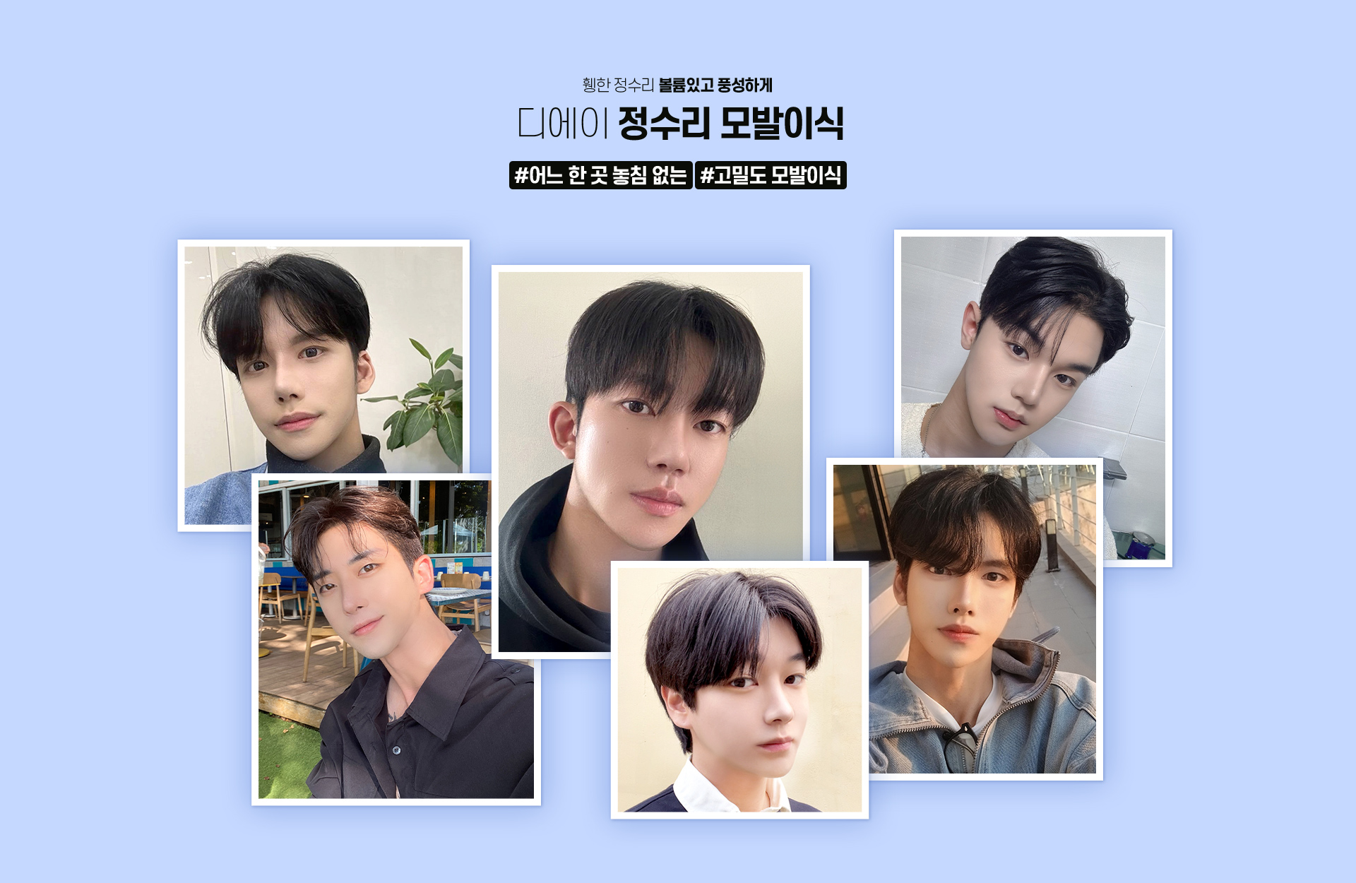 남자 정수리 모발이식