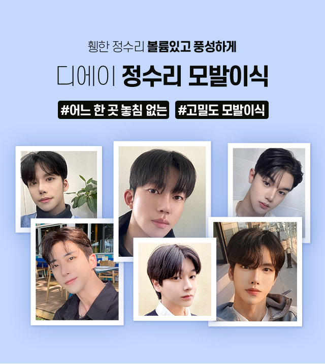 남자 정수리 모발이식