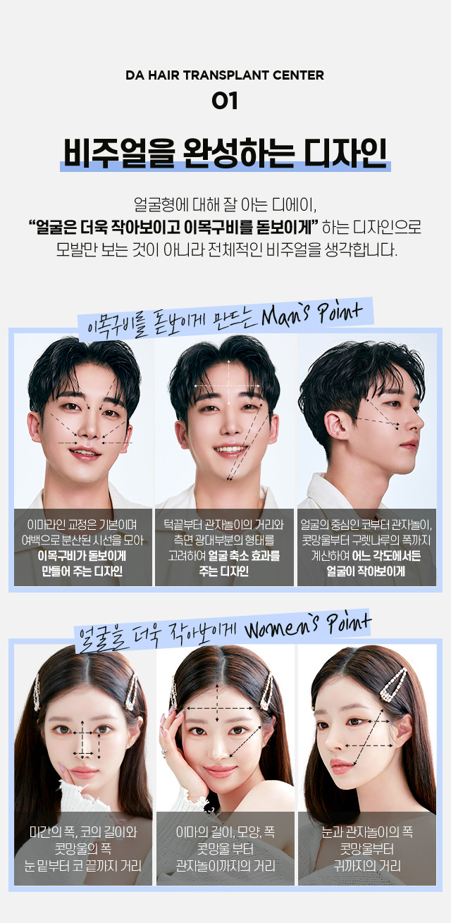 비절개 모발이식