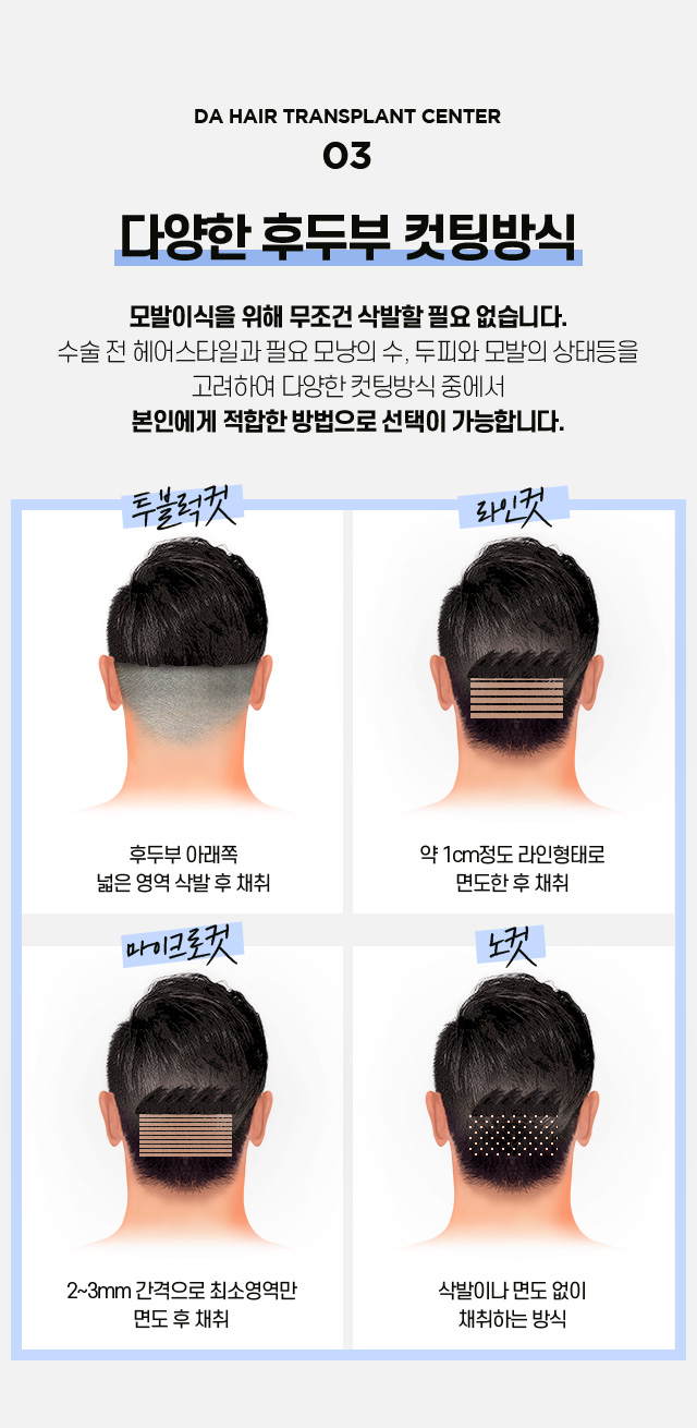 비절개 모발이식