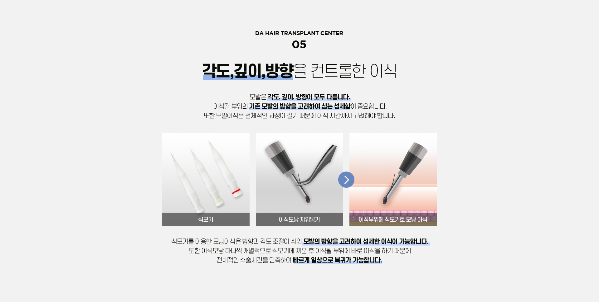 비절개 모발이식