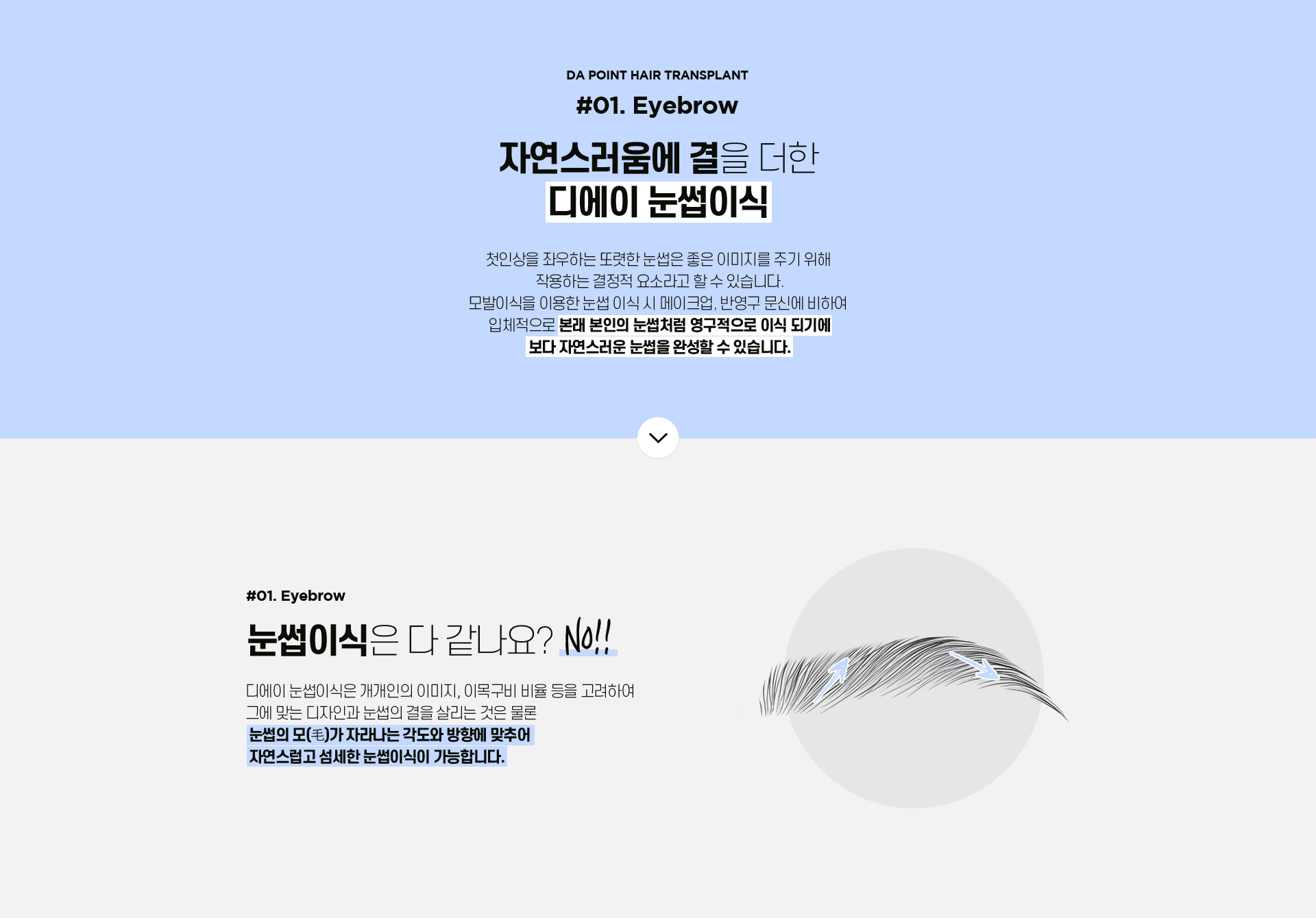 포인트 모발이식