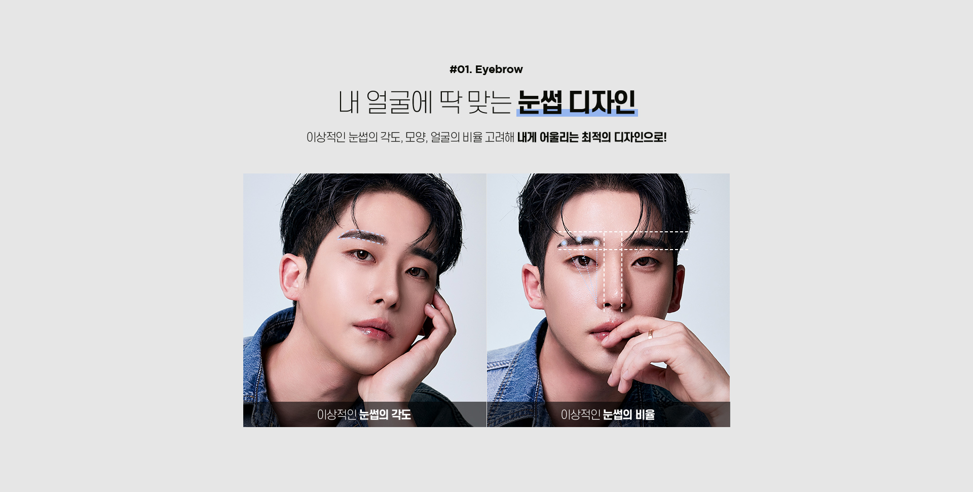 포인트 모발이식