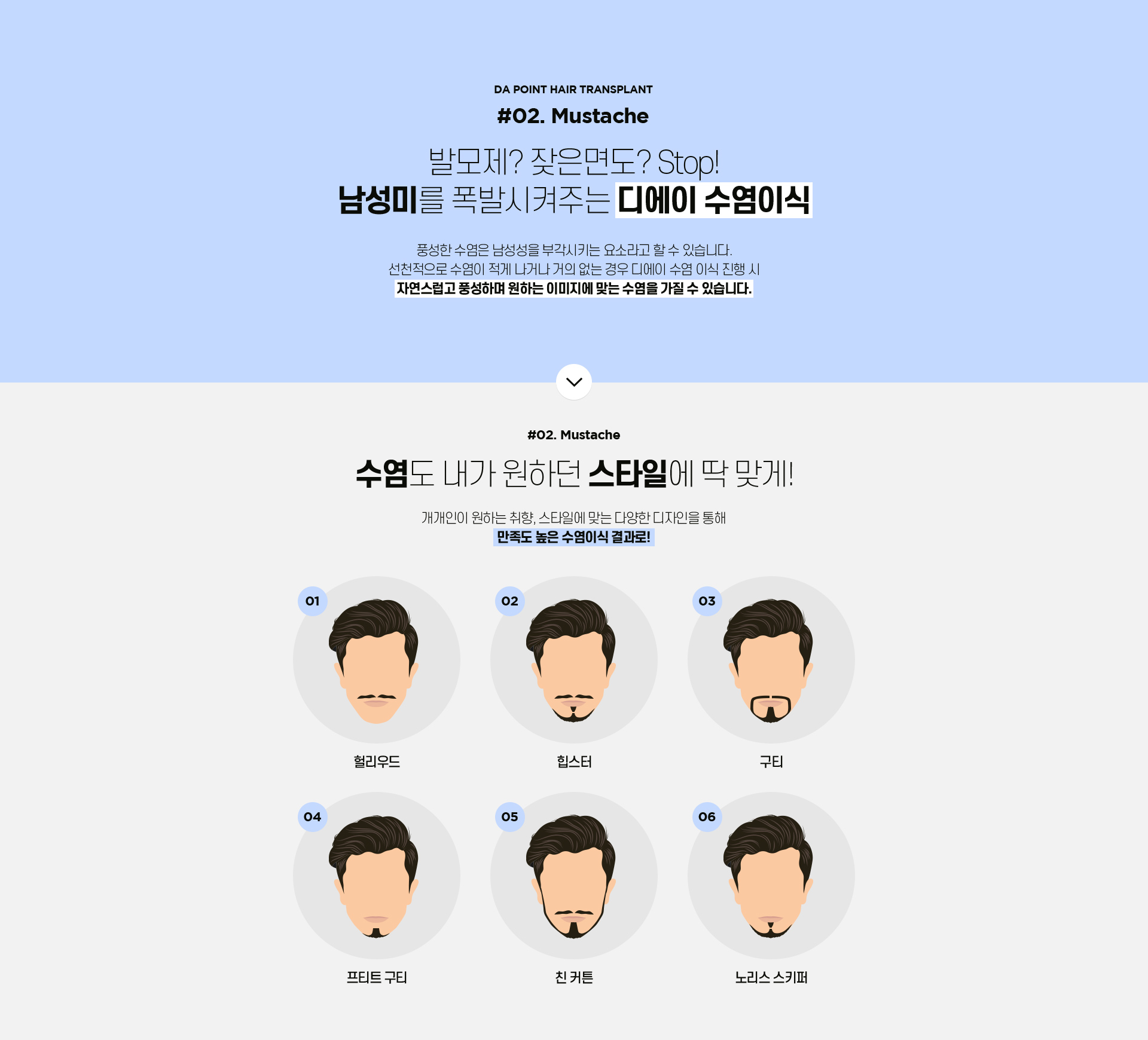 포인트 모발이식