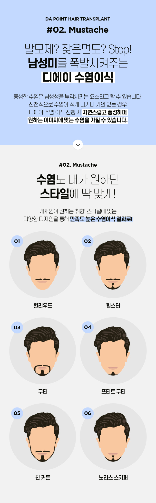 포인트 모발이식