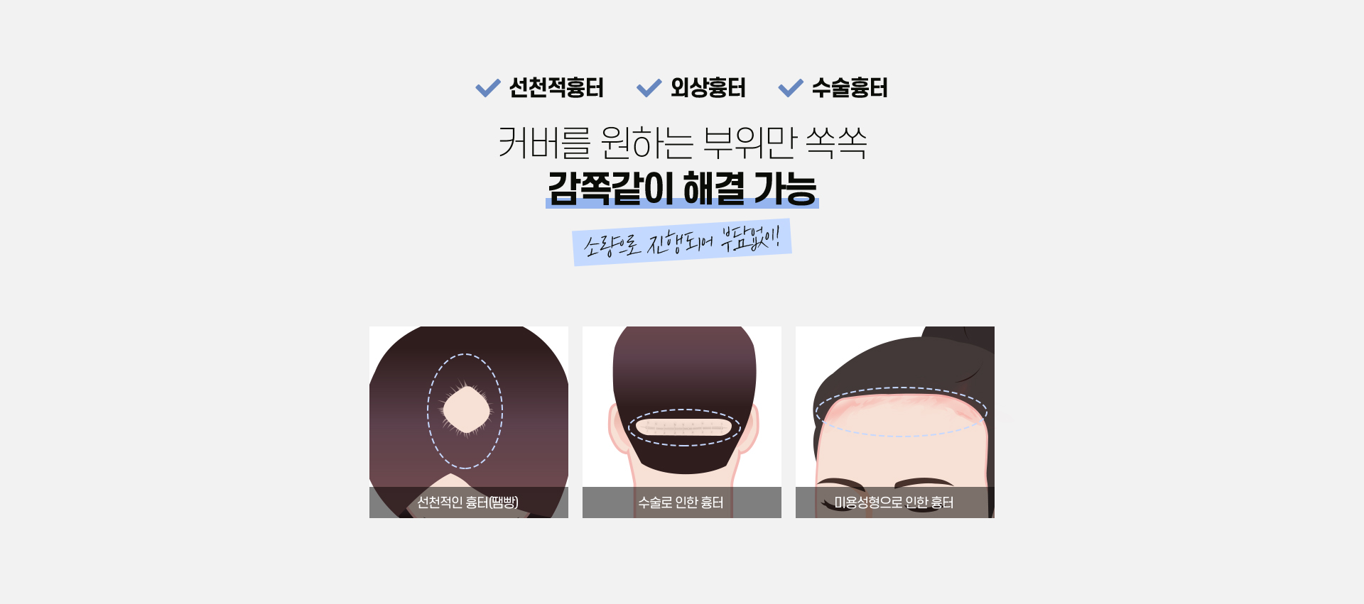 흉터 모발이식