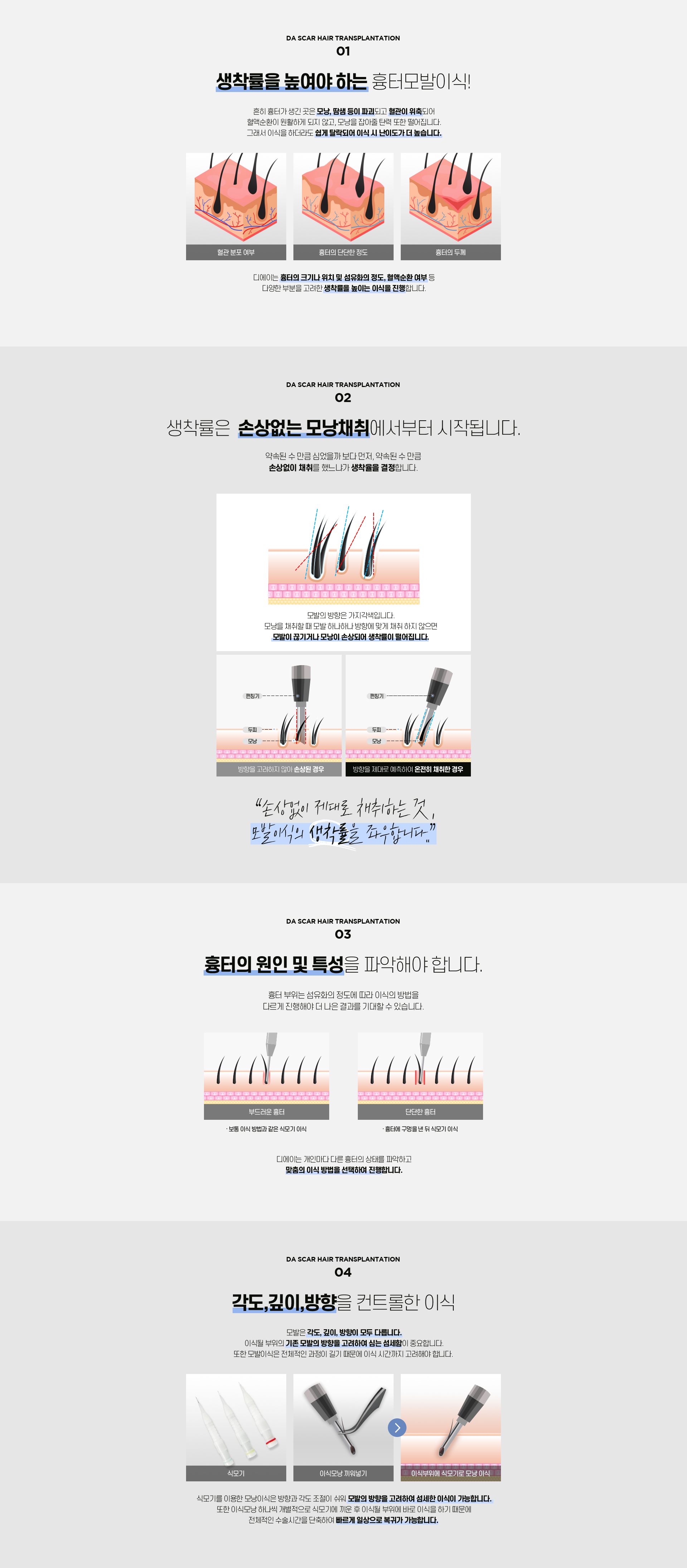 흉터 모발이식