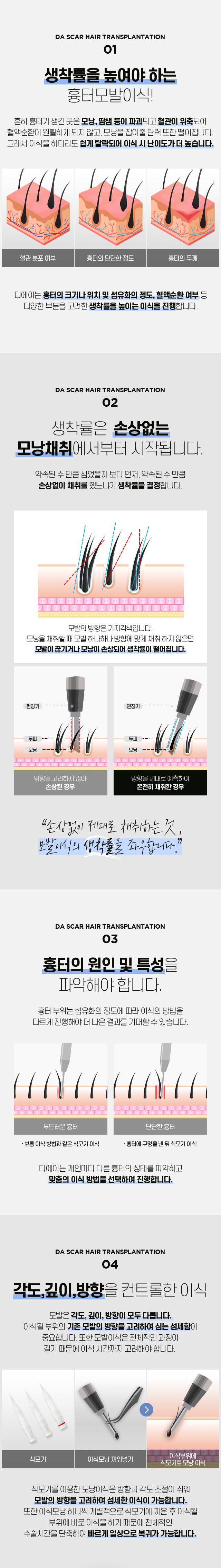 흉터 모발이식